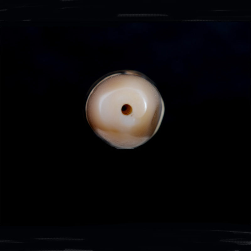 BC3252 | Old Agate Bhaisajyaguru Dzi Bead – 05